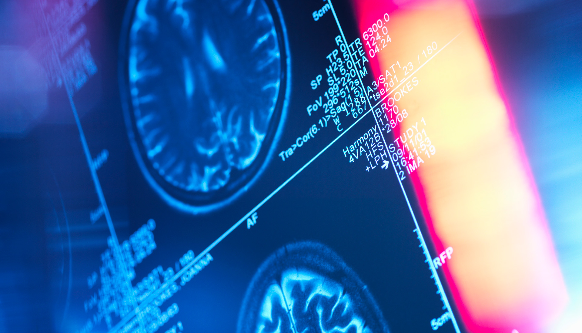 brain scan in a neurology clinic